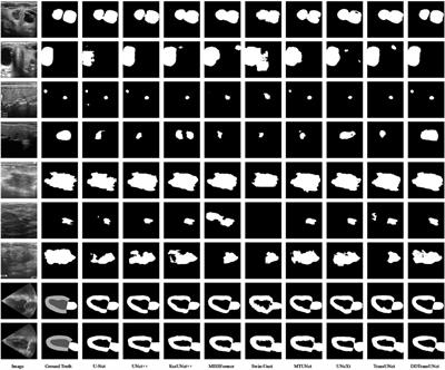 A dual-branch and dual attention transformer and CNN hybrid network for ultrasound image segmentation